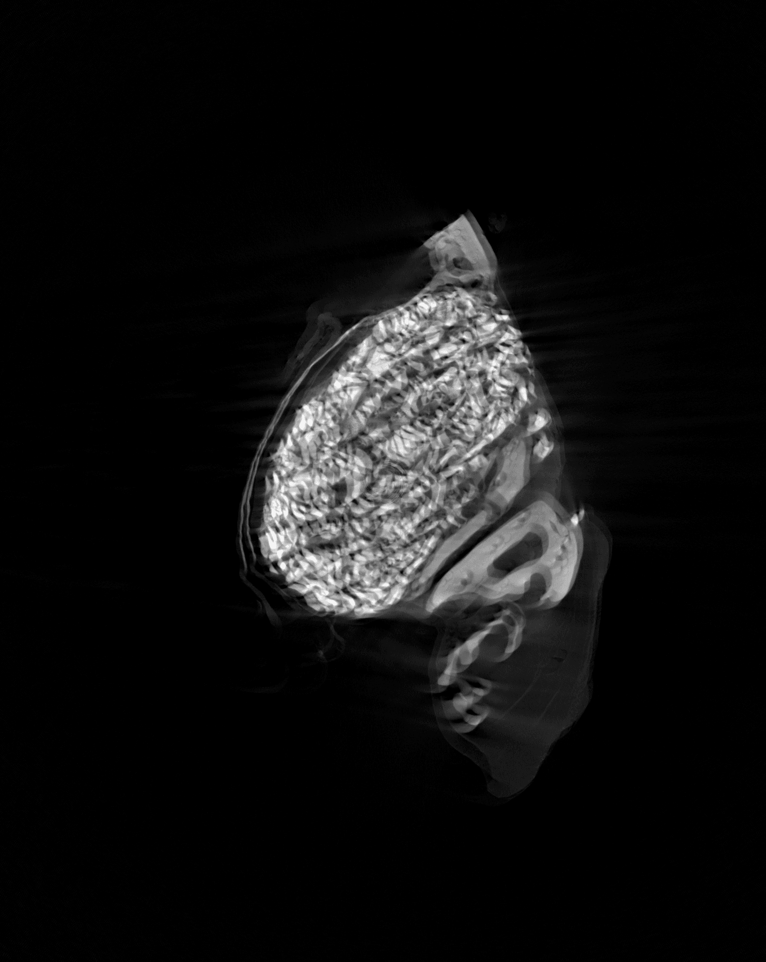 Object moved during scan